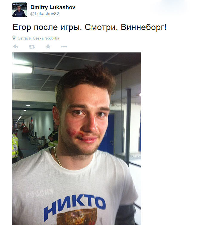 Егор Яковлев после игры со сборной США Егор Яковлев после игры со сборной США