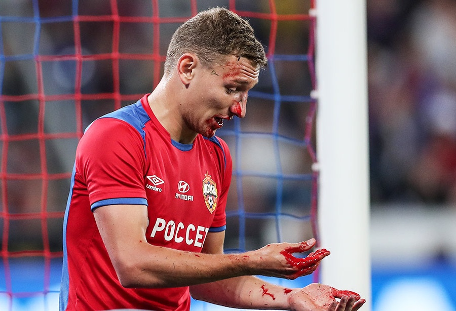 miladinovich razbil chalovu nos v konce