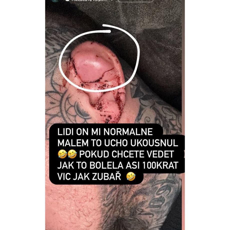 Прокушенное ухо Вацлава Микулашека