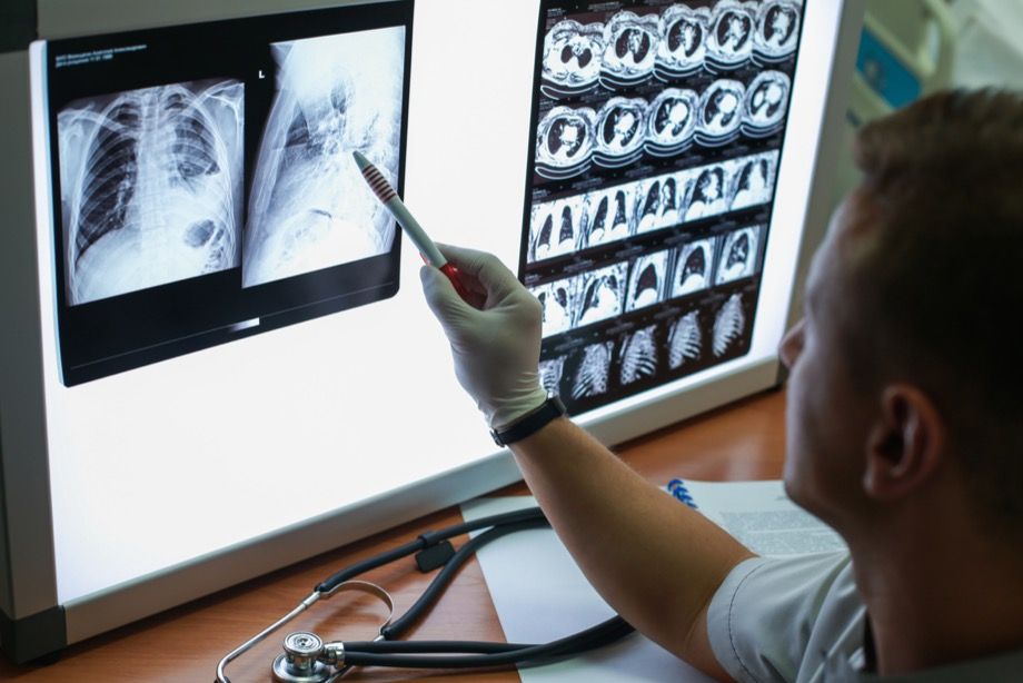 3 верных способа уберечься от радиации во время рентгена