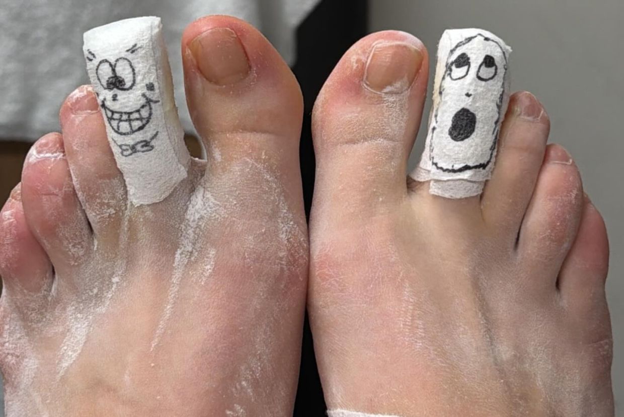 Весёлые заклейки на ногах Мирры