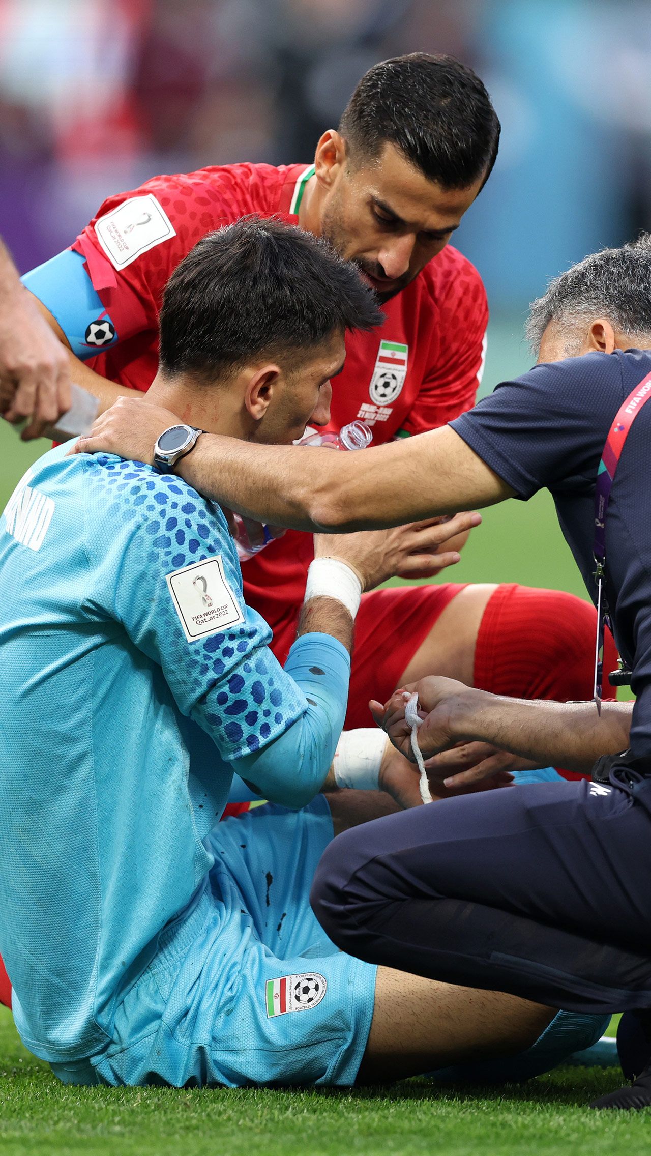 Вратарь иранской сборной также оказался вне игры во время встречи с Англией. Уже на восьмой минуте Алиреза Беиранванд столкнулся с защитником своей команды и получил серьёзную травму. В итоге он ненадолго потерял сознание. А потом был заменён.