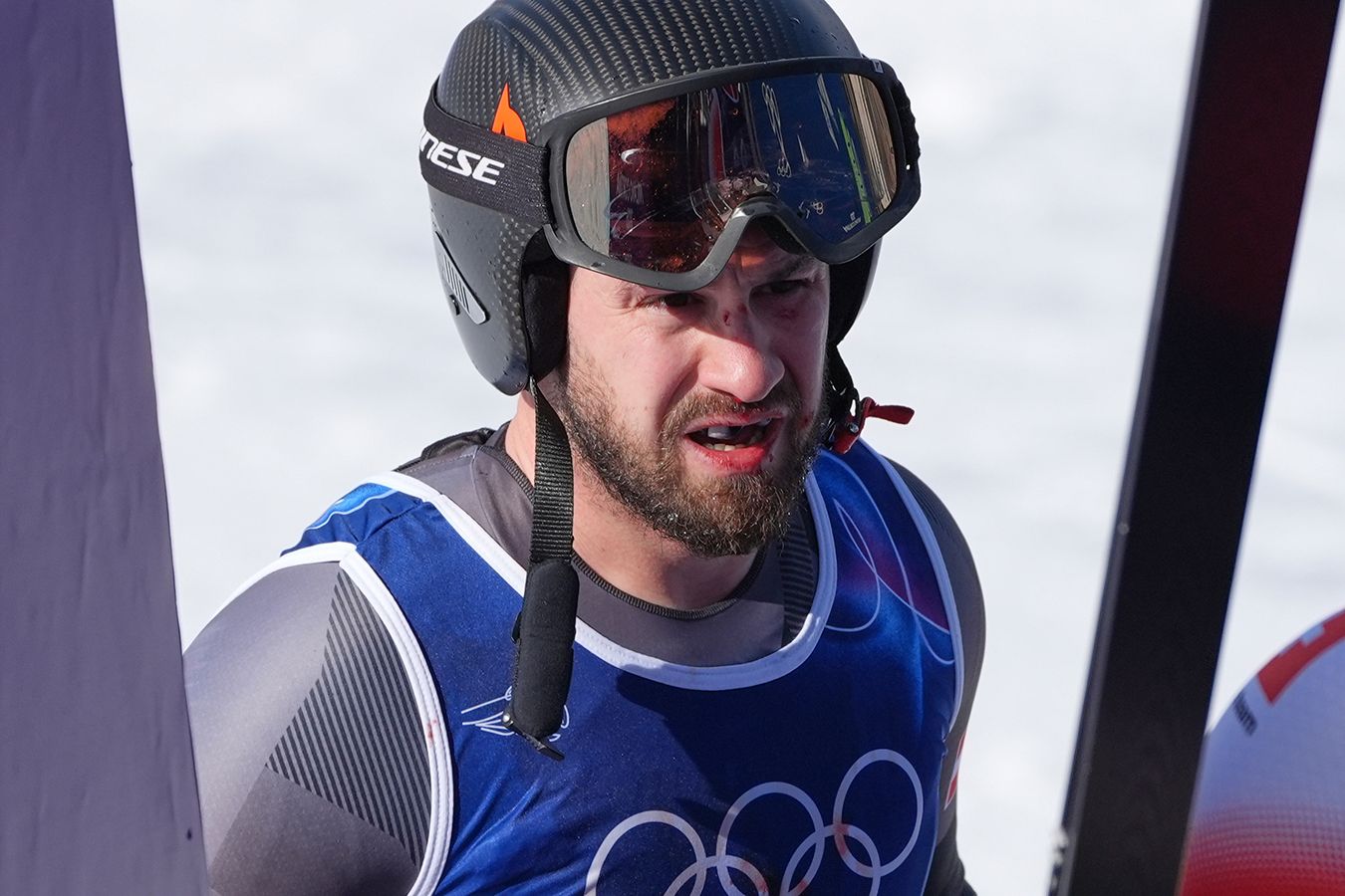 Австрийский горнолыжник разбил лицо в кровь на тренировке перед Олимпиадой-2026