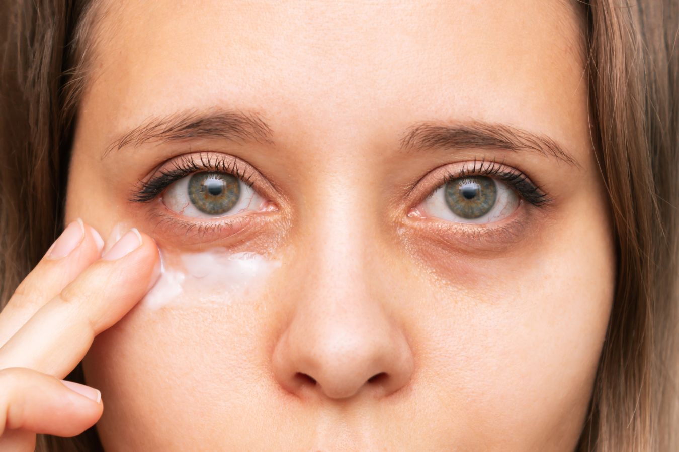 Как убрать мешки и отеки под глазами в домашних условиях - советы офтальмологов и косметологов