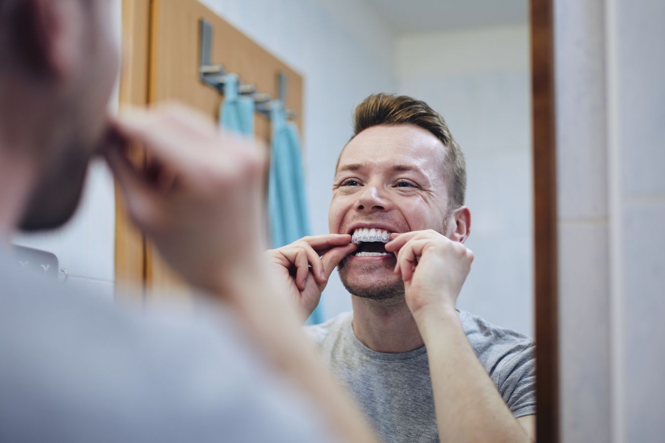 Стоматолог объяснил, почему домашние наборы для отбеливания зубов могут быть опасными