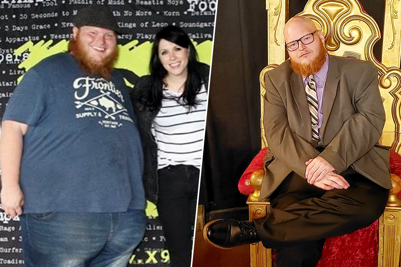 Дейзи тейлор до операции и после фото. Ральф «Сонни» Баргер. Дейзи Тейлор до операции
