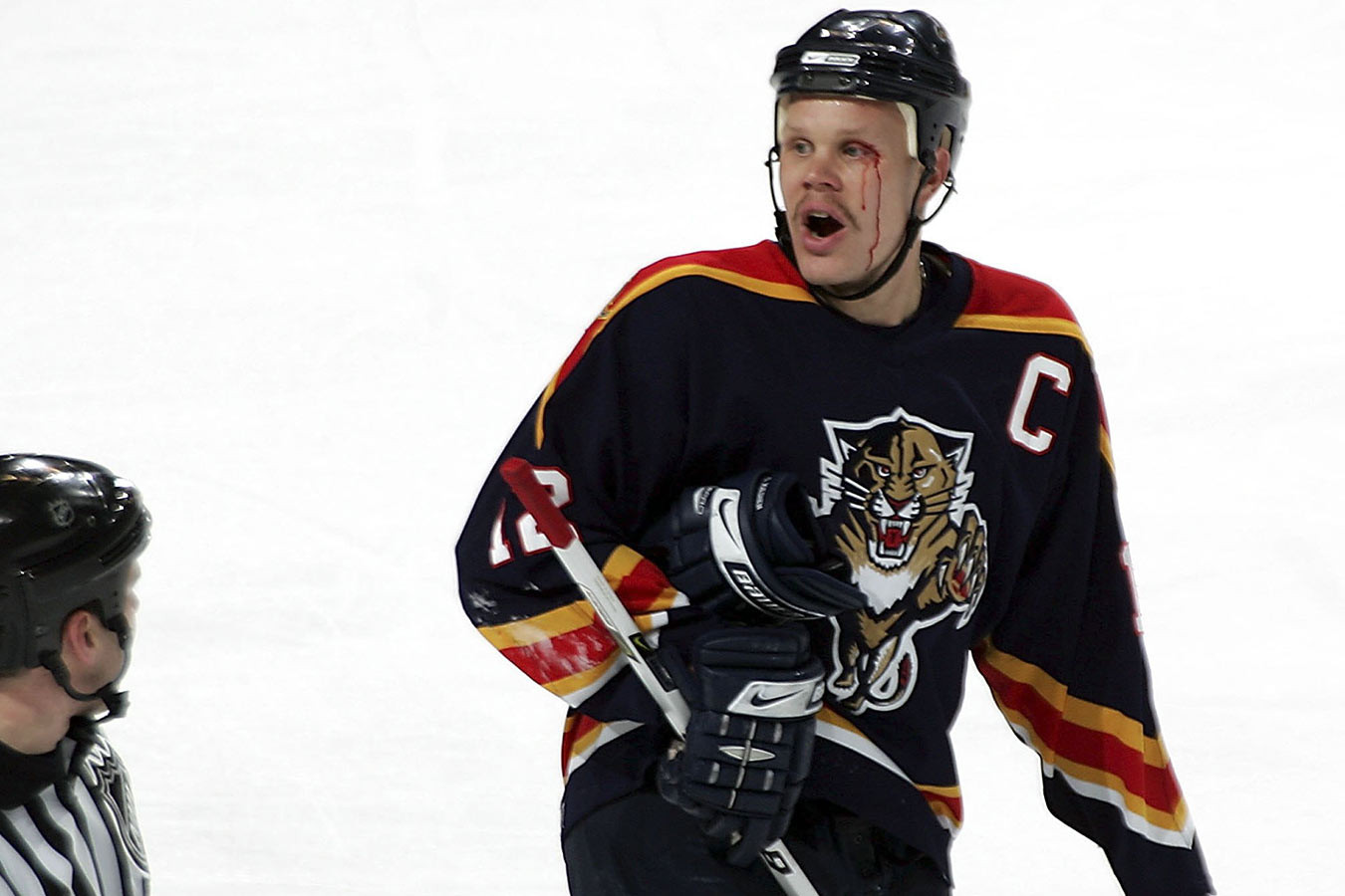 Хоккеист НХЛ закончил карьеру из-за страшной травмы глаза. Хорошо, что остался зрячим