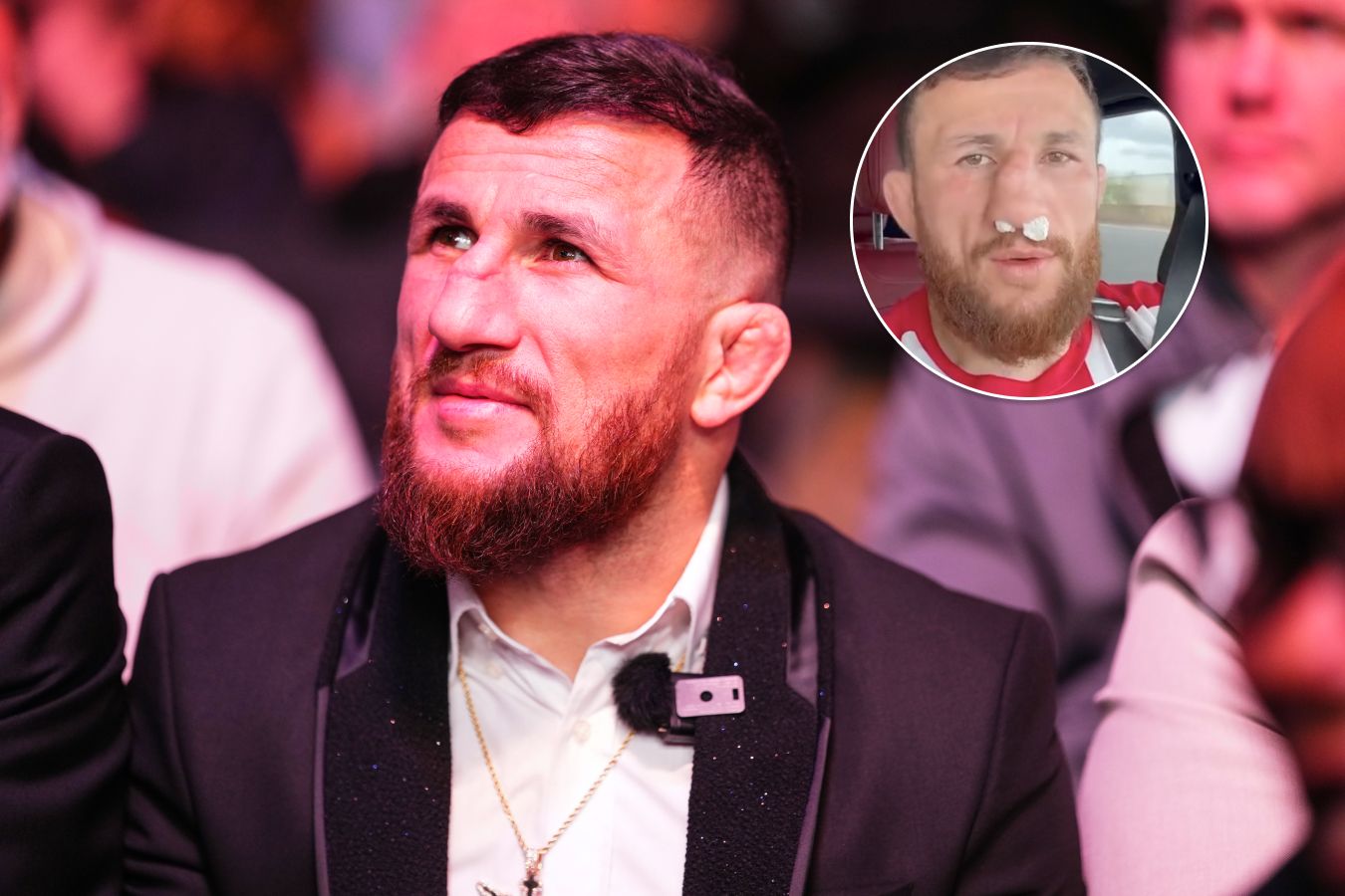 Мерабу Двалишвили жестоко сломали нос