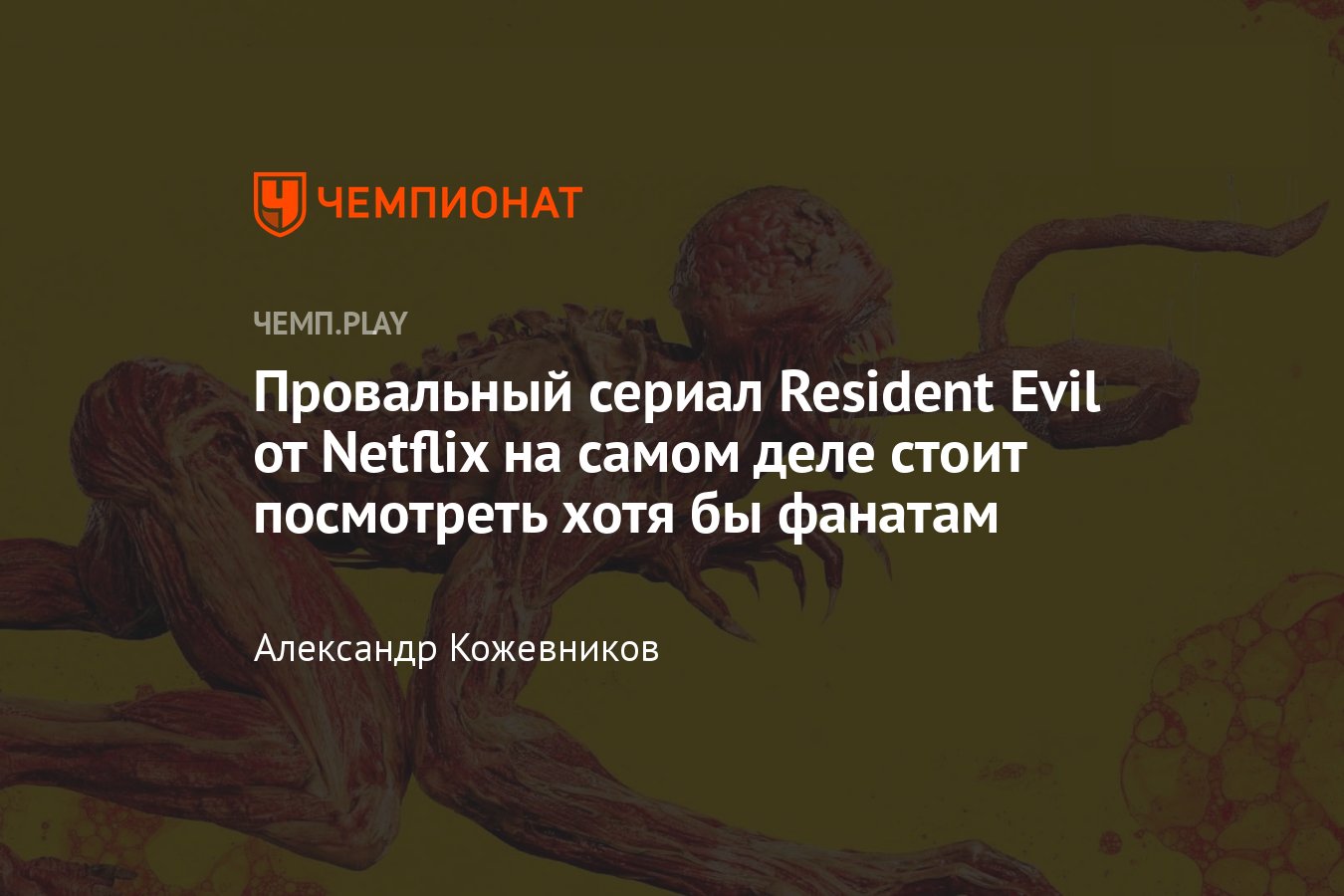 Обзор сериала Resident Evil от Netflix — темнокожий Вескер с честным  каноном из игр - Чемпионат