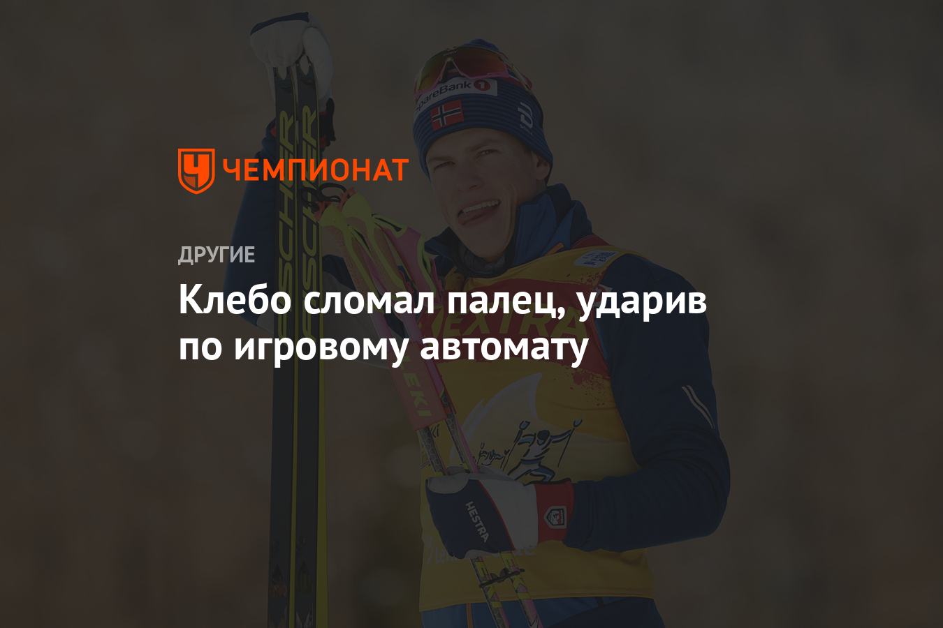 Клебо сломал палец, ударив по игровому автомату - Чемпионат