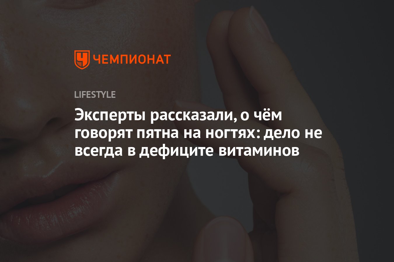 Почему появляются белые пятна на ногтях и что с этим делать