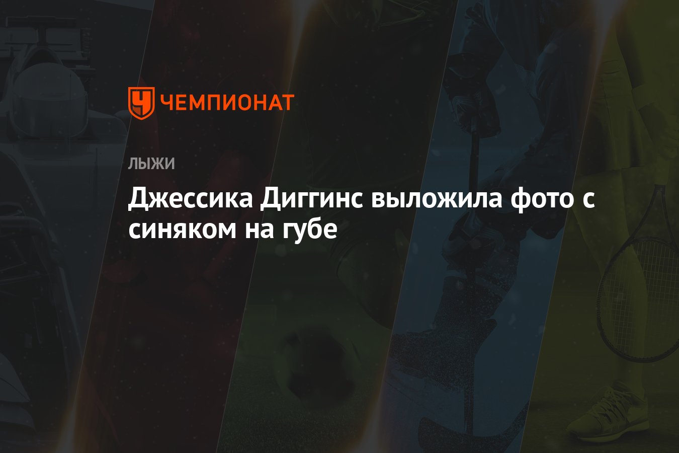 Джессика Диггинс выложила фото с синяком на губе - Чемпионат