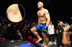 Стафилококк губит карьеры бойцов ММА