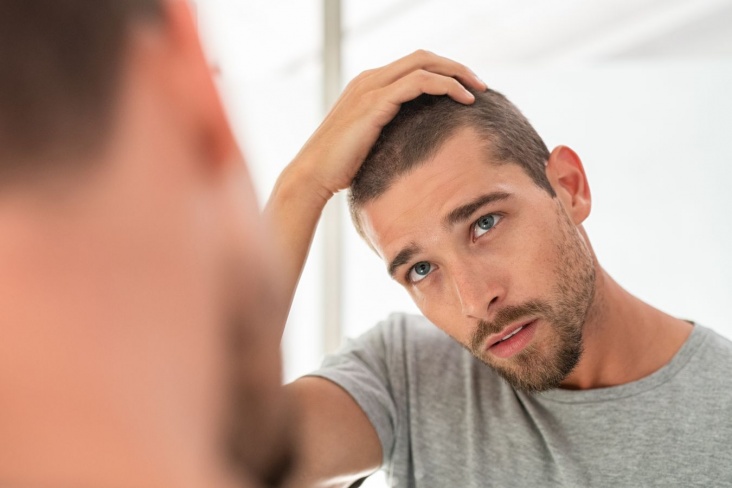 Как восстановить волосы после облысения