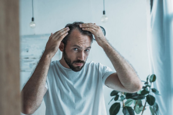 Как остановить выпадение волос у мужчин
