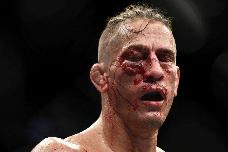 Боец получил жуткую гематому на UFC 249